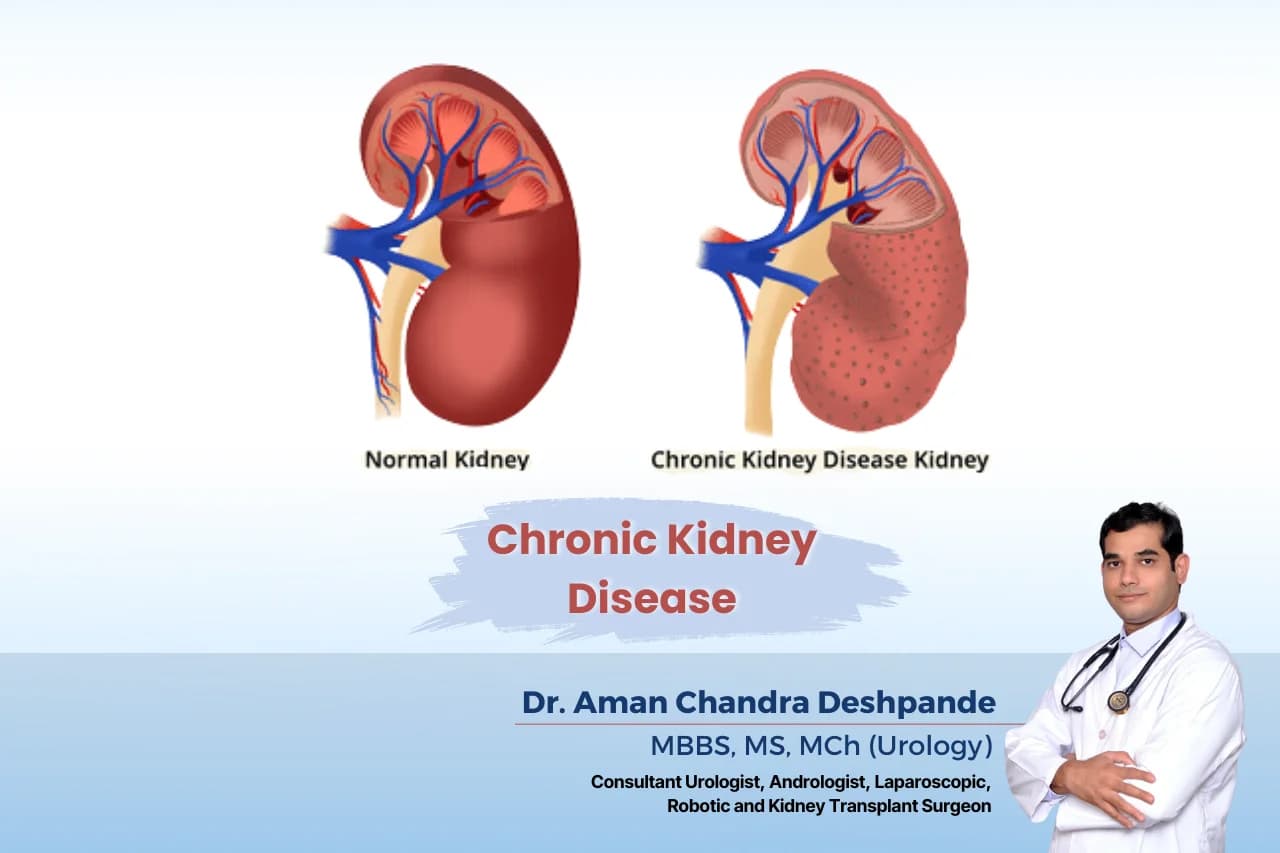 Chronic kidney treatment by Dr Aman Chandra Deshpande, Hyderabad