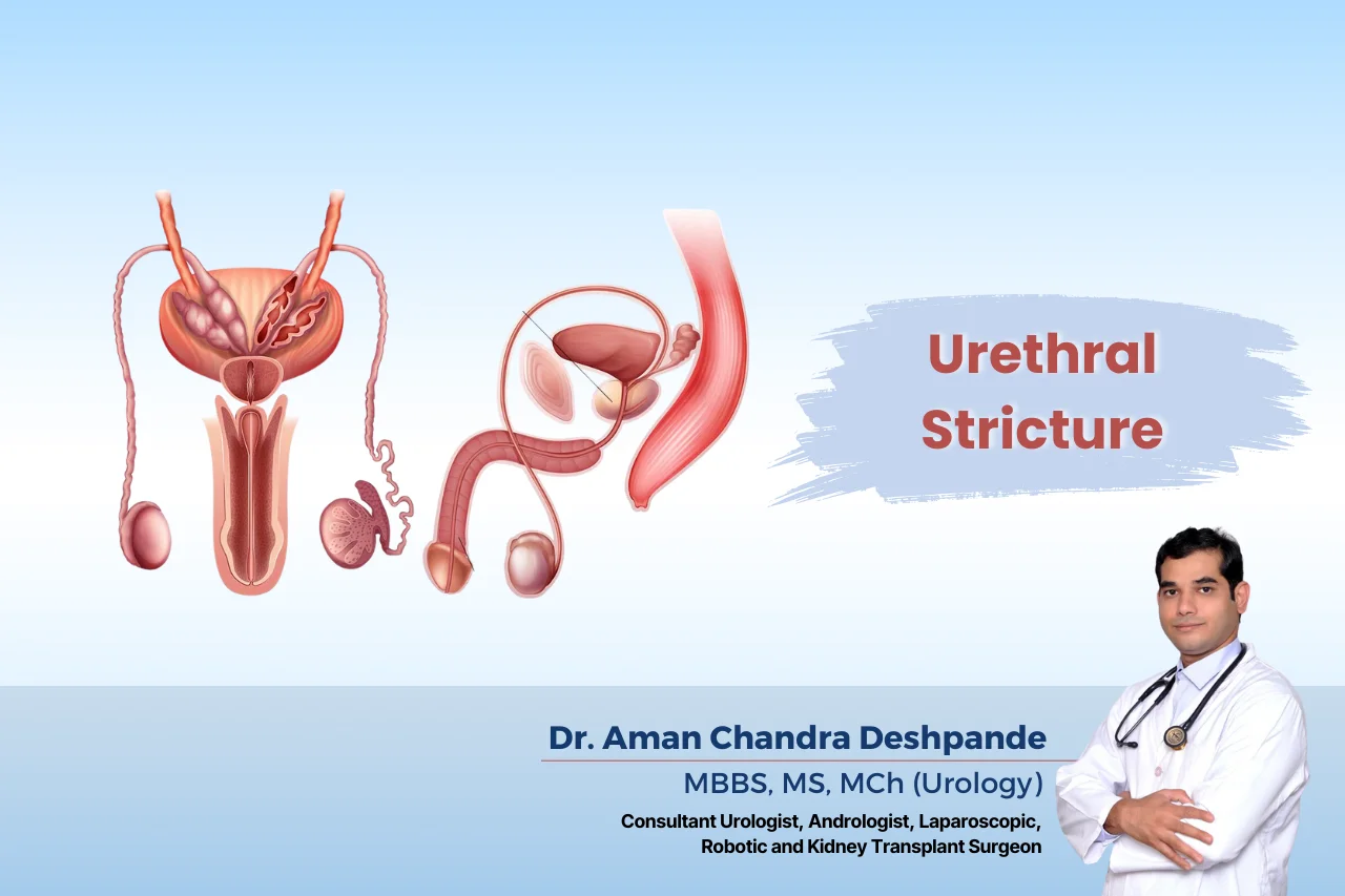 urethral-stricture in  hyderabad