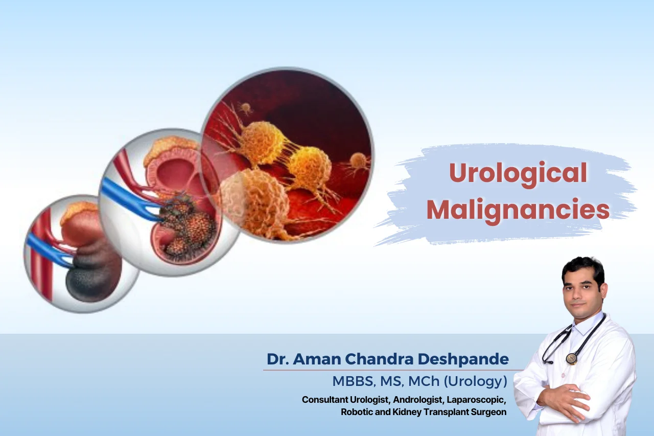 urological-malignancies in hyderabad